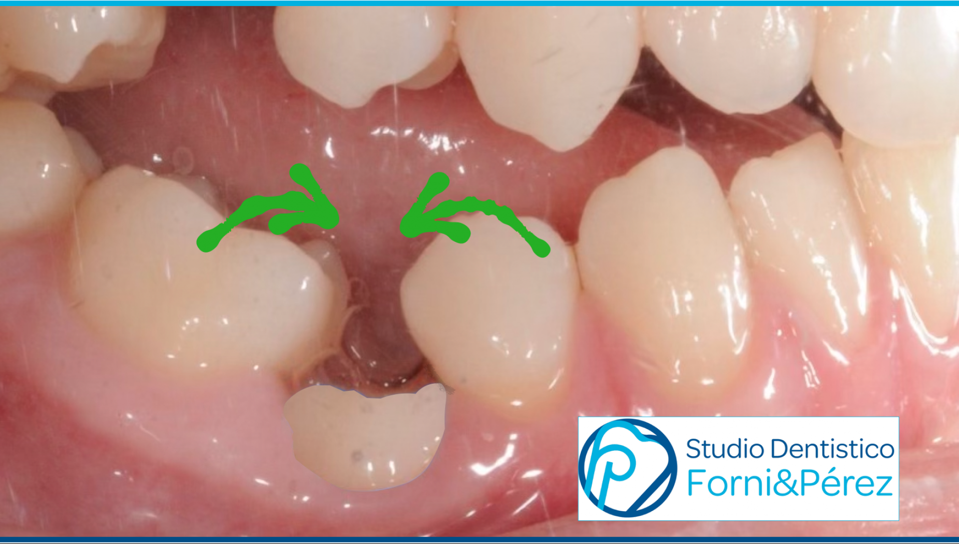 Ornamento retrò a forma di cavallo a dondolo in legno, intagliato a